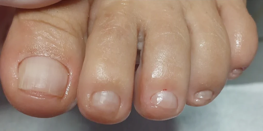 Limpeza completa — Depois